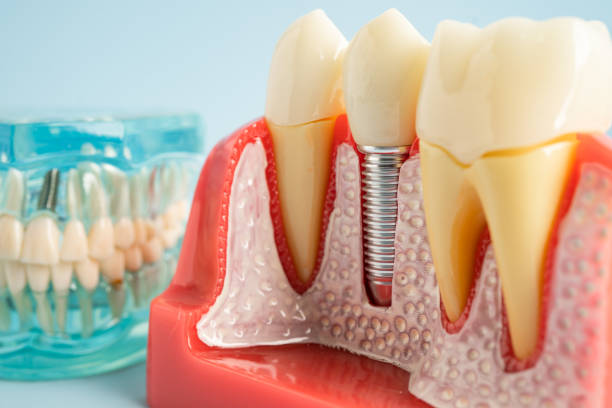 Best Dental Studio in Miami Springs, FL